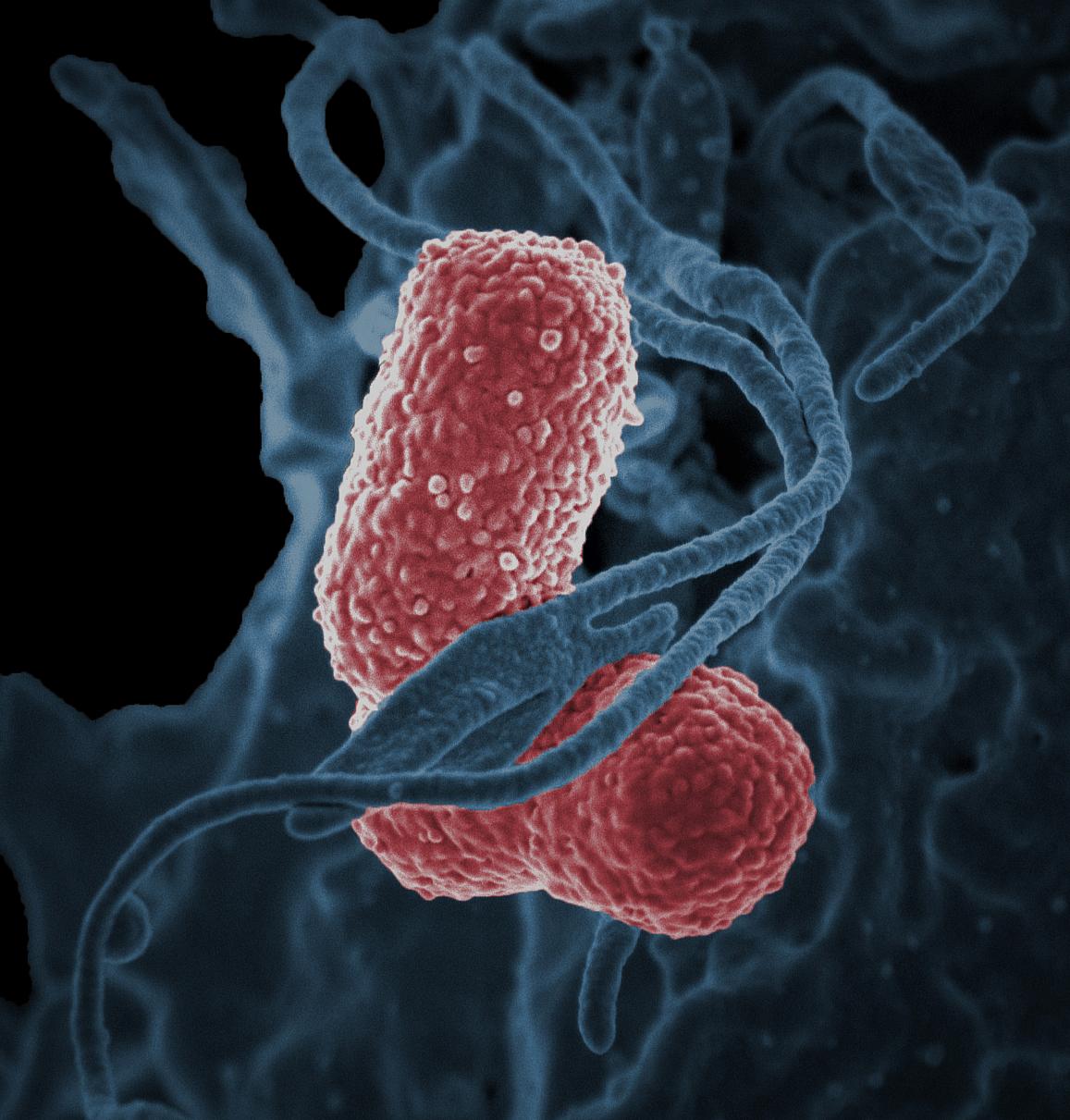 klebsiella bacteria